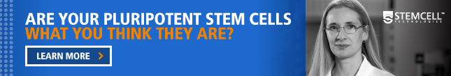 Are Your Pluripotent Stem Cells What You Think They Are?