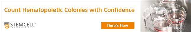 Count Colonies with Confidence. Register for our CFU Assay Training Course.