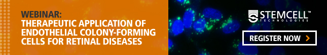 Webinar on the Therapeutic Application of Endothelial Colony-Forming Cells for Retinal Diseases. Register Now!