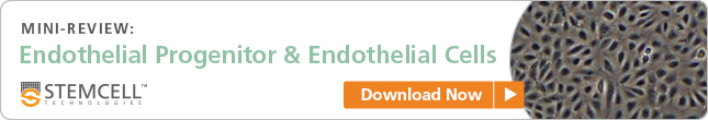 Download Mini-Review: Endothelial Progenitor and Endothelial Cells
