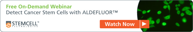 [Watch the Video] Detect Cancer Stem Cells with ALDEFLUOR™.