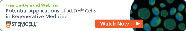 [Free On-Demand Webinar] Potential Applications of ALDH+ Cells in Regenerative Medicine - Watch Now.