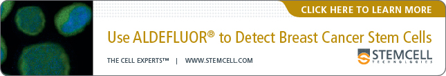 Use Aldefluor to Detect Breast Cancer Stem Cells - Click here to learn more - 645x110