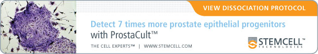 Detect 7 times more prostate epithelial progenitors with ProstaCult