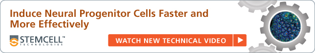 Induce Neural Progenitor Cells Faster and More Effectively - Watch New Technical Video
