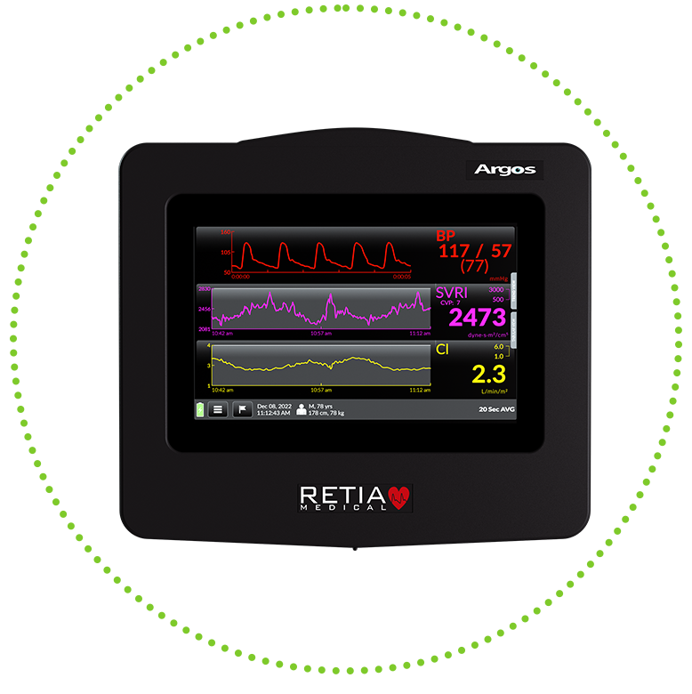 ARGOS™* cardiac output monitor