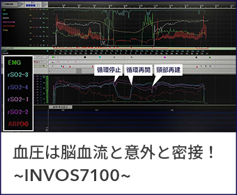 INVOS™︎ 7100 4つの特長