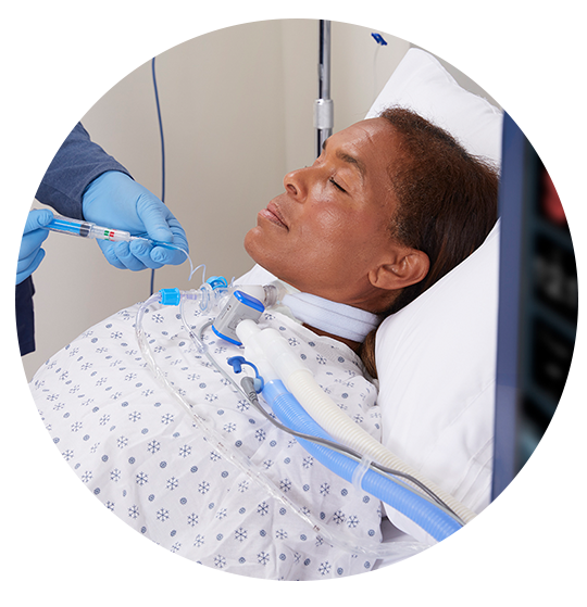 patient on ventilator