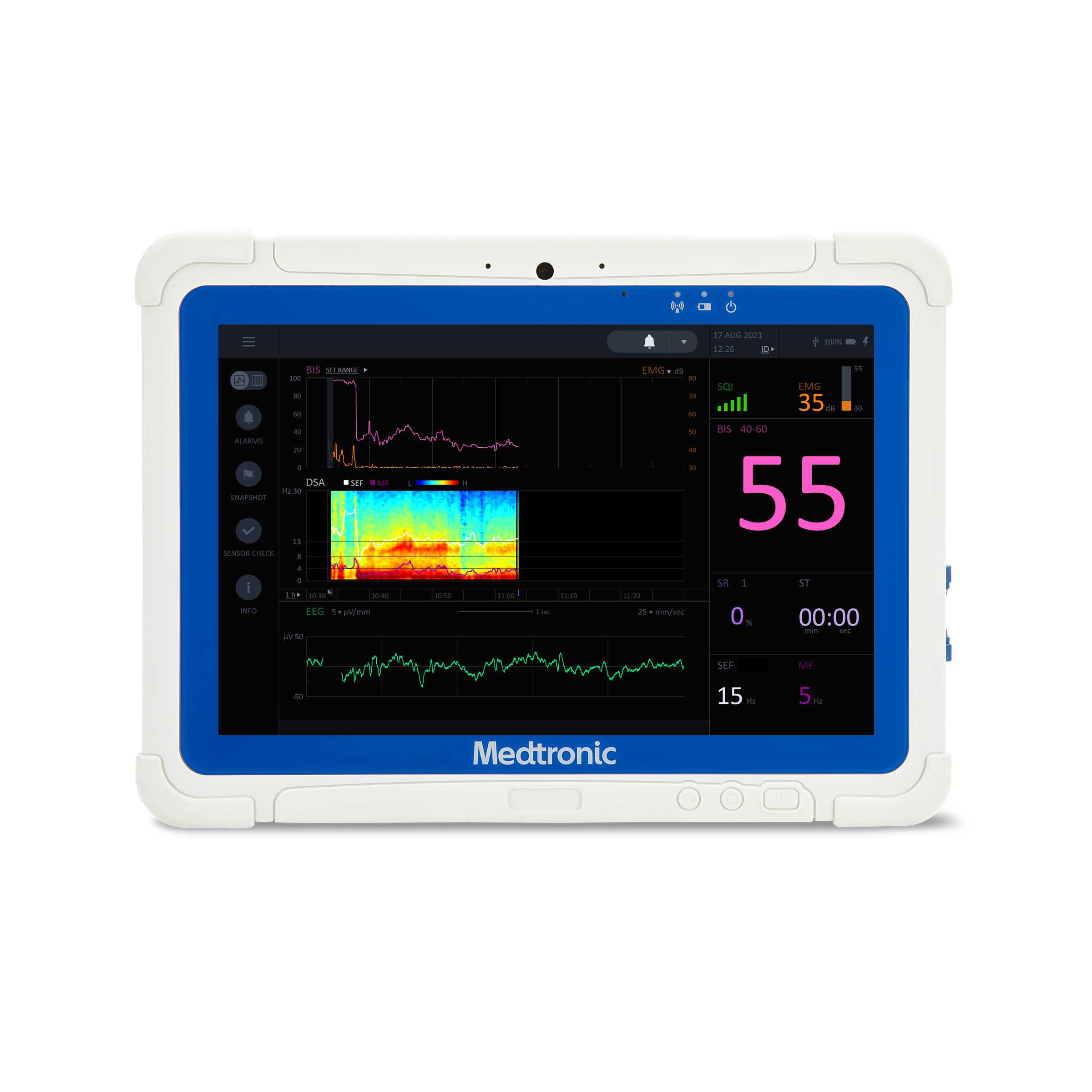BIS™ Advance brain monitoring system