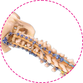 Soluciones Medtronic para cervical