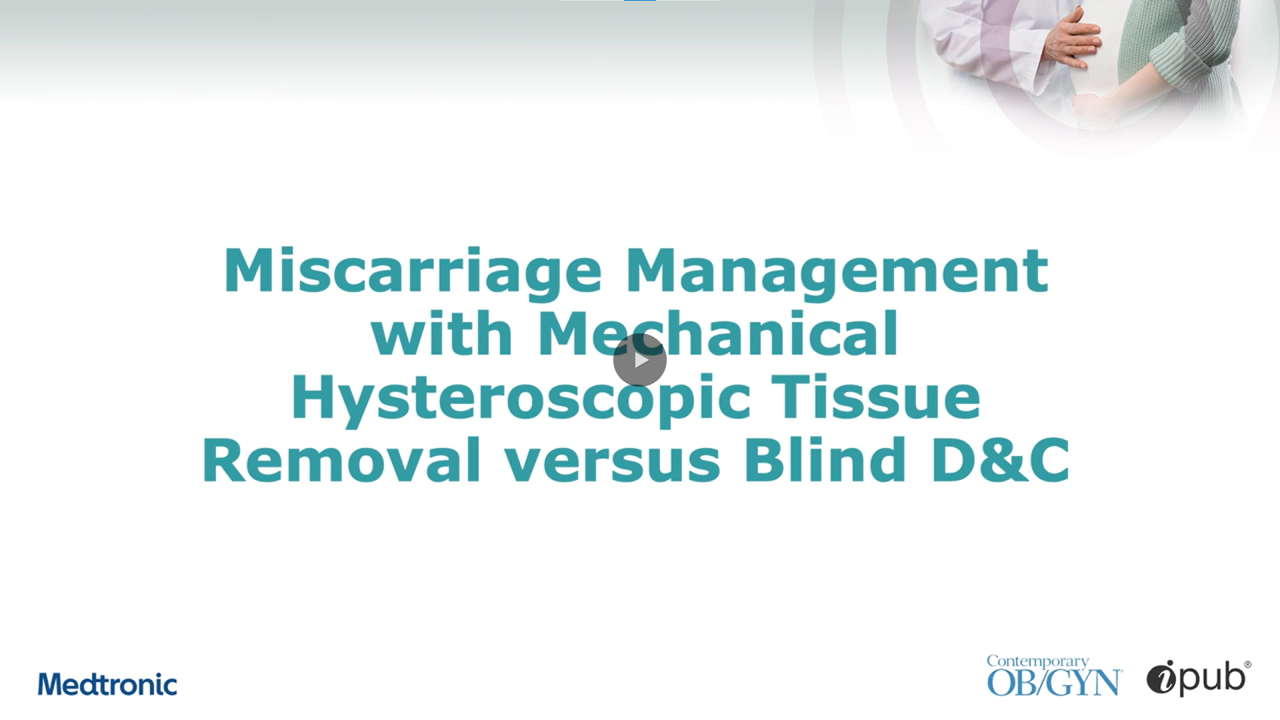 Miscarriage Management with Mechanical Hysteroscopic Tissue Removal versus Blind D&C