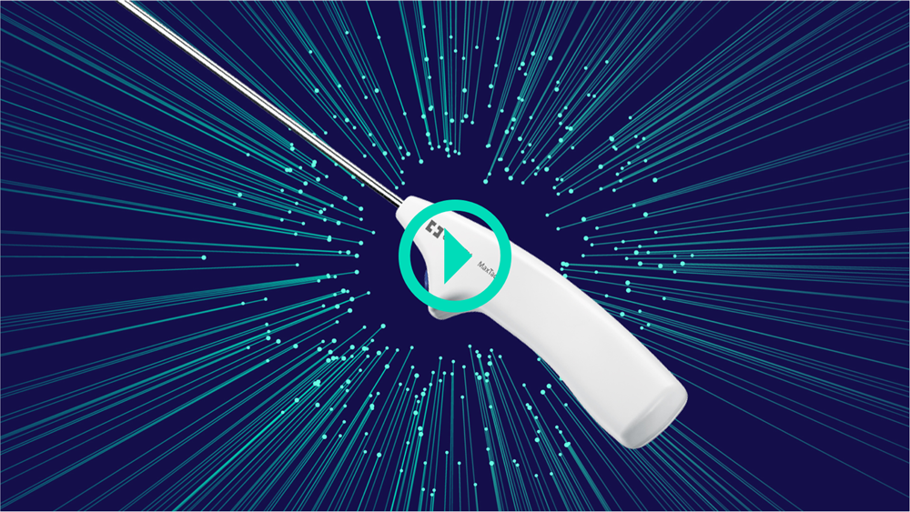 Powering the future of mesh fixation: Watch now