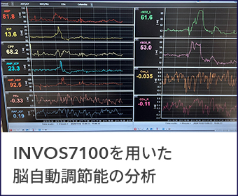 INVOS™︎ 7100 4つの特長