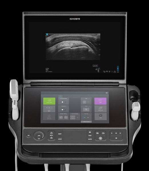 Sonosite PX - Advanced Image Clarity