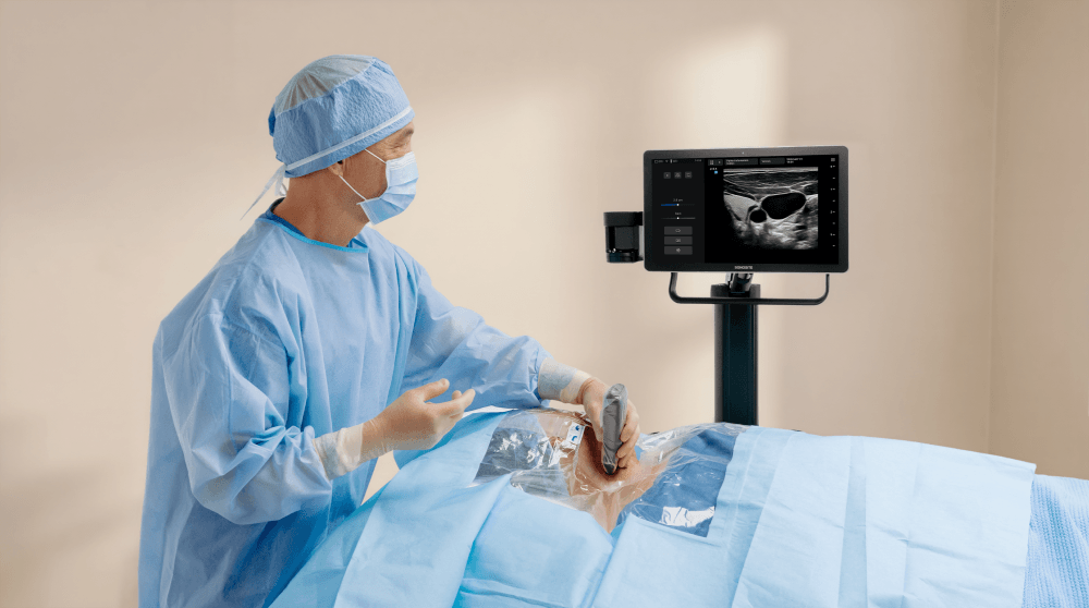 Wireless transducer at bedside
