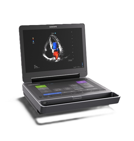 Image of Sonosite MT off stand and open
