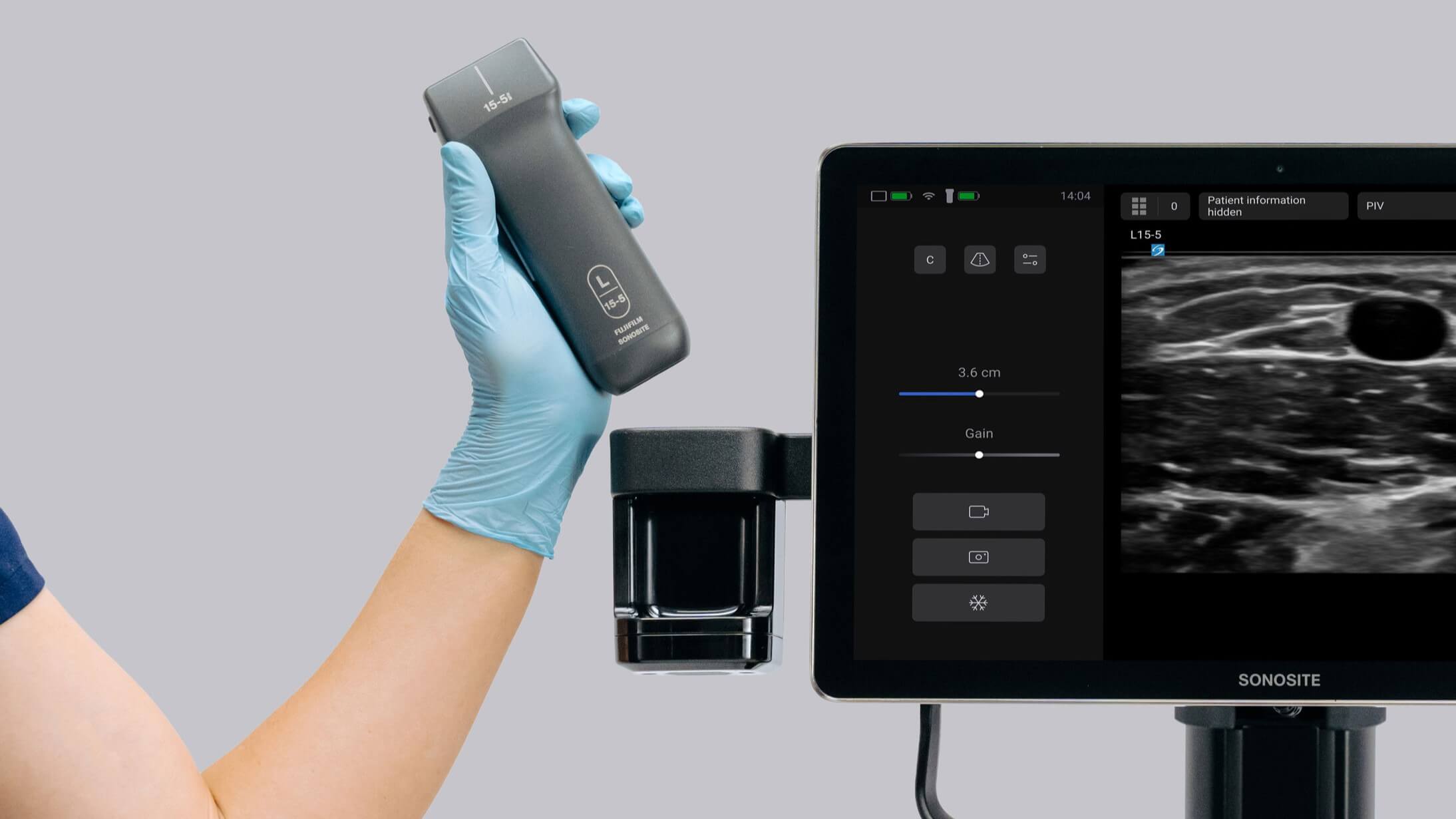 Wireless transducer at bedside