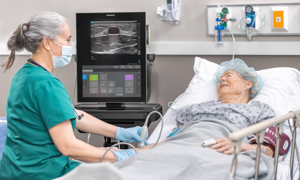 Sonosite Ultrasound ST Machine