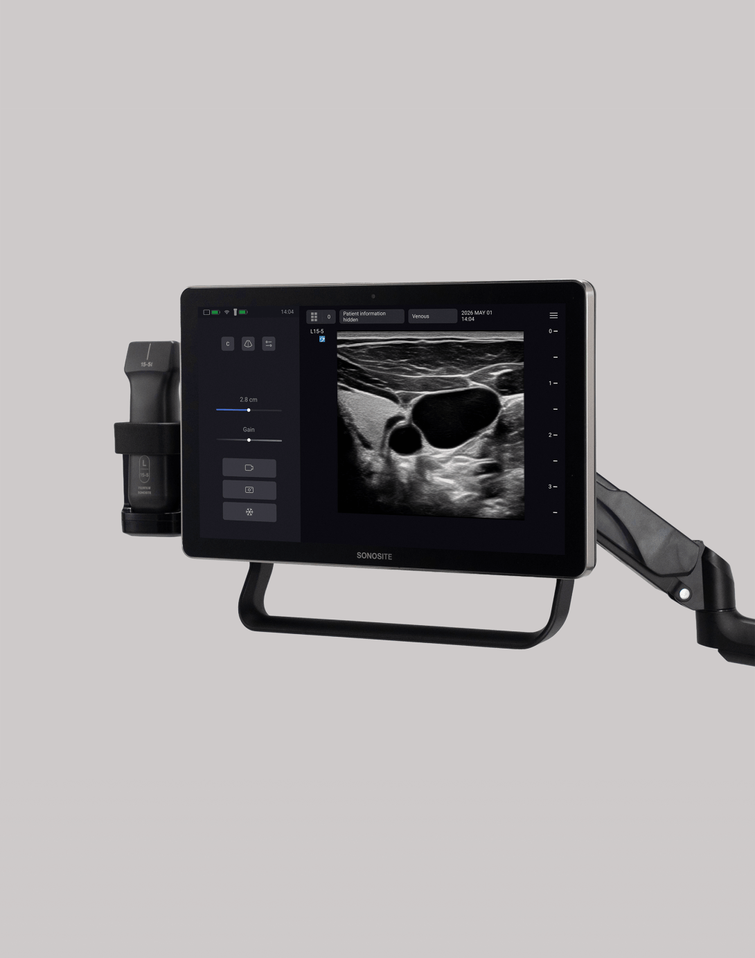 Image of Sonosite MT on stand