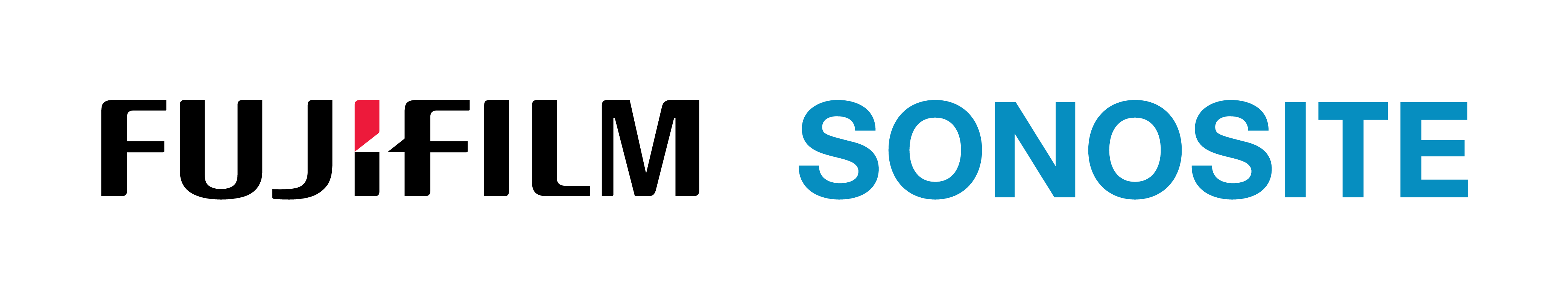 It's about time. | Sonosite