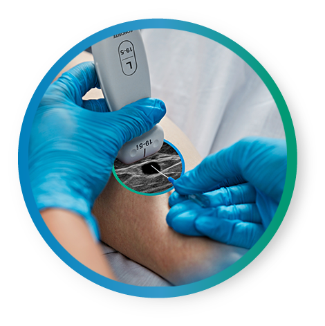 closeup of a patient's arm and nurse using ultrasound to help find a vein for IV