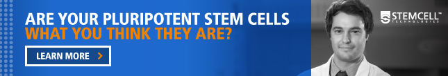 Are Your Pluripotent Stem Cells What You Think They Are?