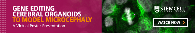 Virtual Poster Presentation: CRISPR-Cas9 Gene Editing of Cerebral Organoids to Model Microcephaly