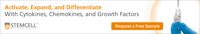 Request a free cytokine, chemokine or growth factor sample