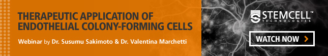 View-On-Demand Webinar: Therapeutic Application of Endothelial Colony-Forming Cells. Watch Now.